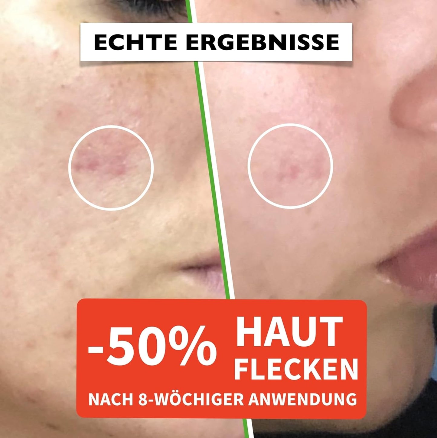 60ml Bio Hyaluron Serum mit Vitamin C, E. Hochkonzentriert Anti-Falten, Anti-Aging und Dunkle-Flecken. Hyaluronsäure-Gesichtsserum, ideal als Augenkonturcreme und für Dermaroller. Vegane Naturkosmetik