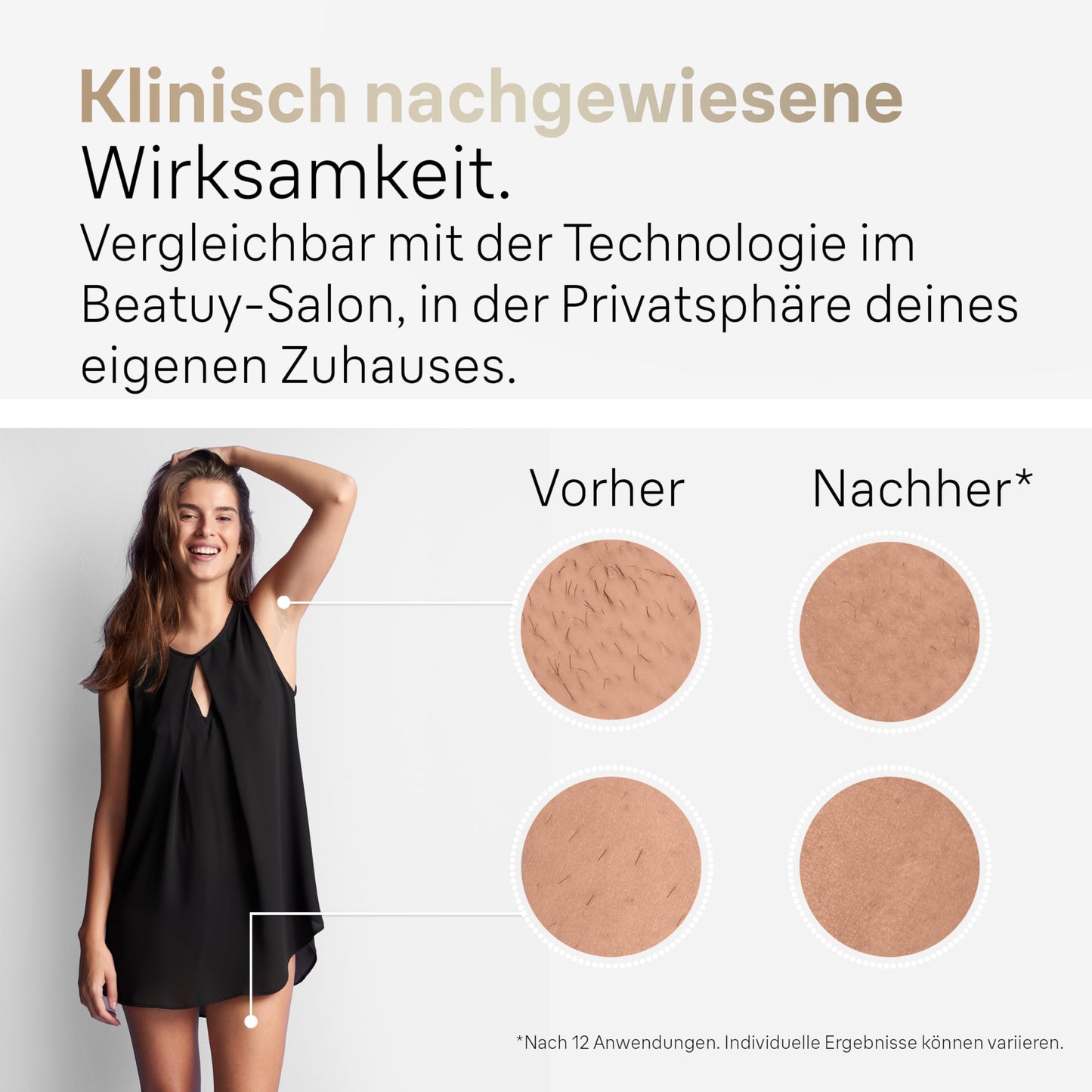 Braun IPL Silk Expert Pro 5 Haarentfernungsgerät Damen, sichtbare Haarentfernung, Designed In Germany, Venus Rasierer, 3 Aufsätze, Alternative zu Laser Haarentfernung, PL5262, weiß/gold